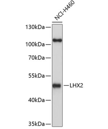 LHX2 Rabbit Polyclonal Antibody