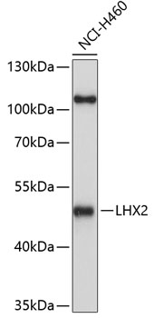 LHX2 Rabbit Polyclonal Antibody