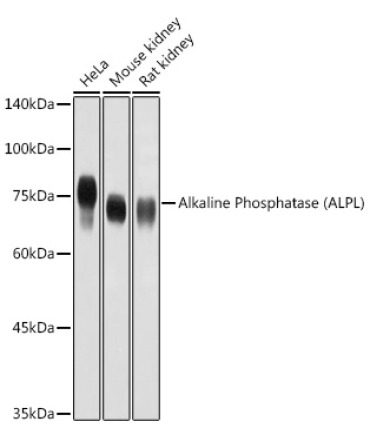Alkaline Phosphatase (ALPL) Rabbit Polyclonal Antibody