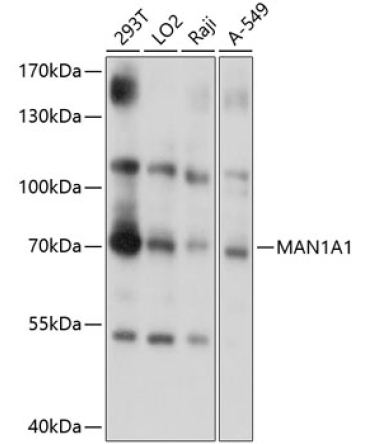 MAN1A1 Rabbit Polyclonal Antibody