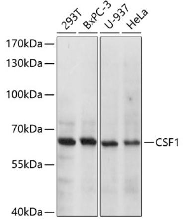 CSF1 Rabbit Polyclonal Antibody