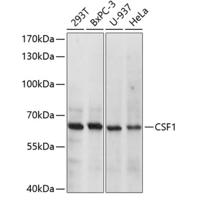CSF1 Rabbit Polyclonal Antibody