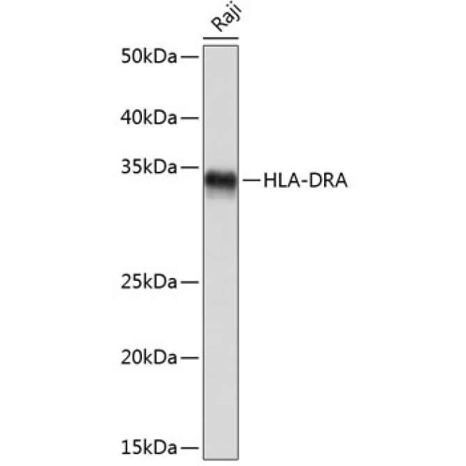 HLA-DRA Rabbit Monoclonal Antibody