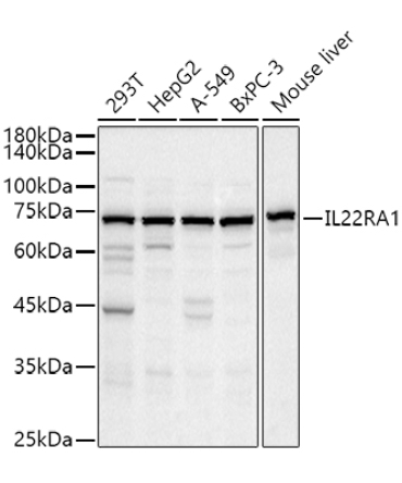 IL22RA1 Rabbit Polyclonal Antibody