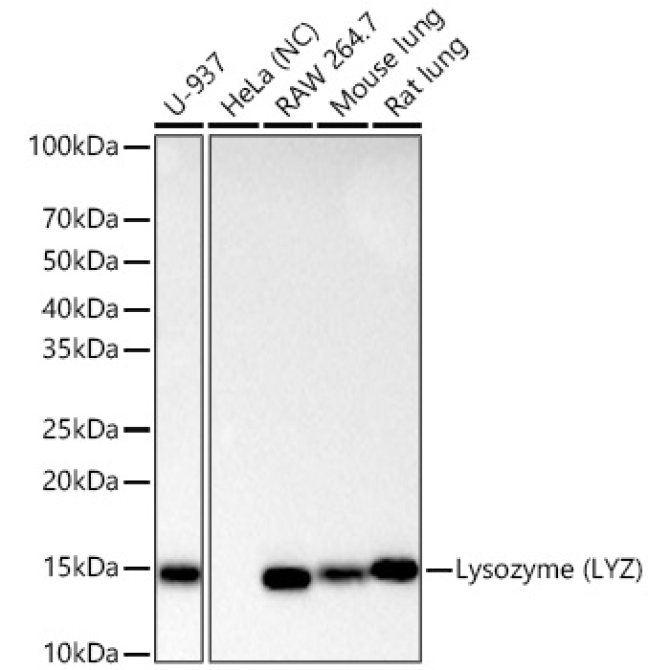 Lysozyme (LYZ) Rabbit Monoclonal Antibody