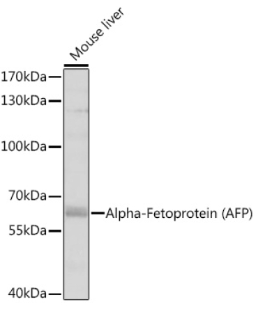 Alpha-Fetoprotein (AFP) Rabbit Polyclonal Antibody