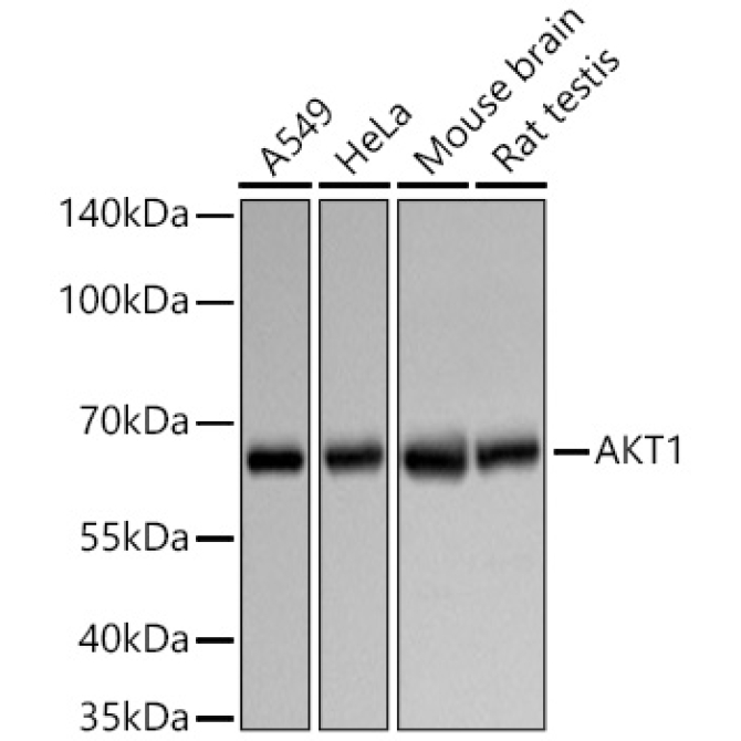 AKT1 Rabbit Polyclonal Antibody