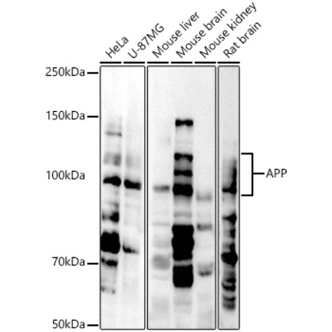 APP Rabbit Polyclonal Antibody