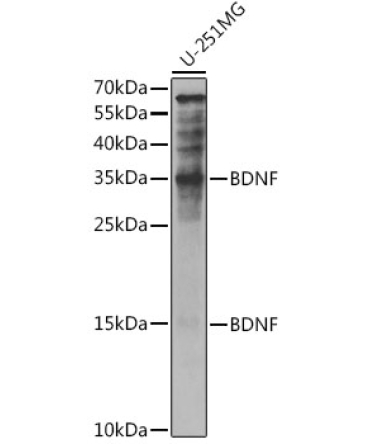 BDNF Rabbit Polyclonal Antibody
