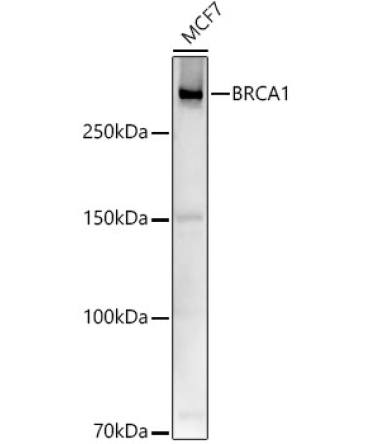 BRCA1 Rabbit Polyclonal Antibody