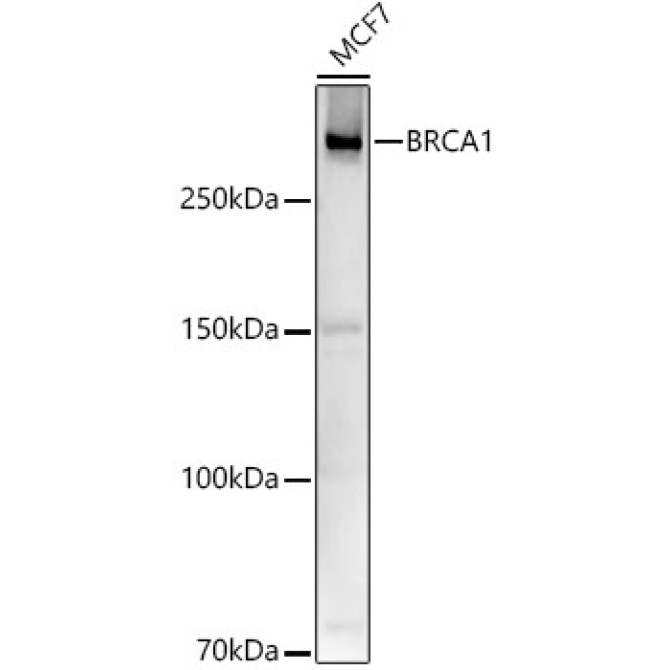 BRCA1 Rabbit Polyclonal Antibody