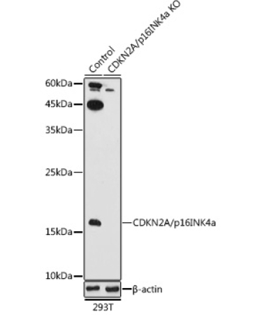 CDKN2A/p16INK4a Rabbit Polyclonal Antibody [KO Validated]