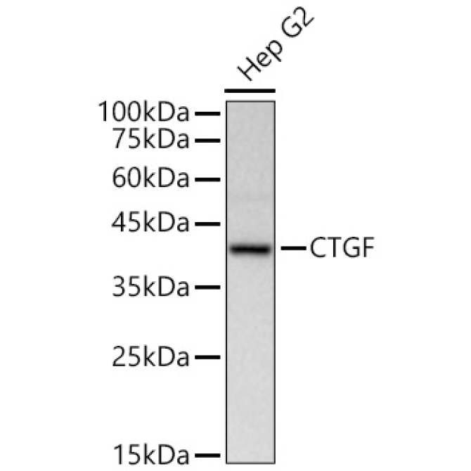 CTGF Rabbit Polyclonal Antibody
