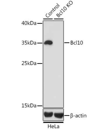 Bcl10 Rabbit Polyclonal Antibody [KO Validated]
