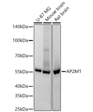 AP2M1 Rabbit Monoclonal Antibody