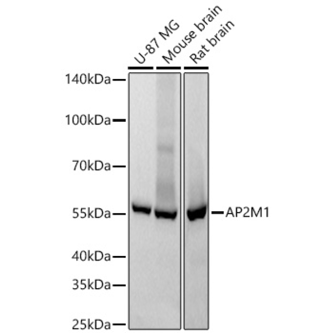 AP2M1 Rabbit Monoclonal Antibody