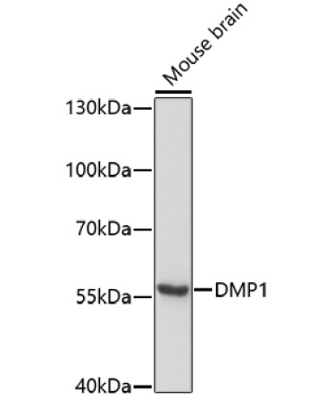 DMP1 Rabbit Polyclonal Antibody