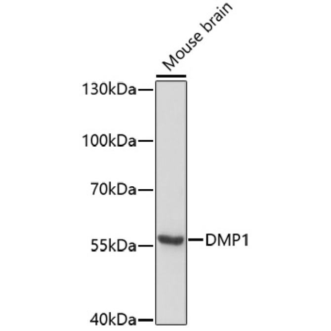 DMP1 Rabbit Polyclonal Antibody
