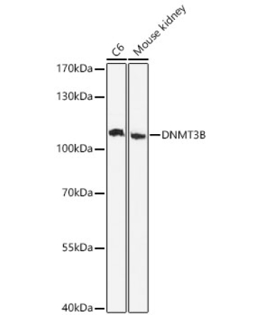 DNMT3B Rabbit Polyclonal Antibody