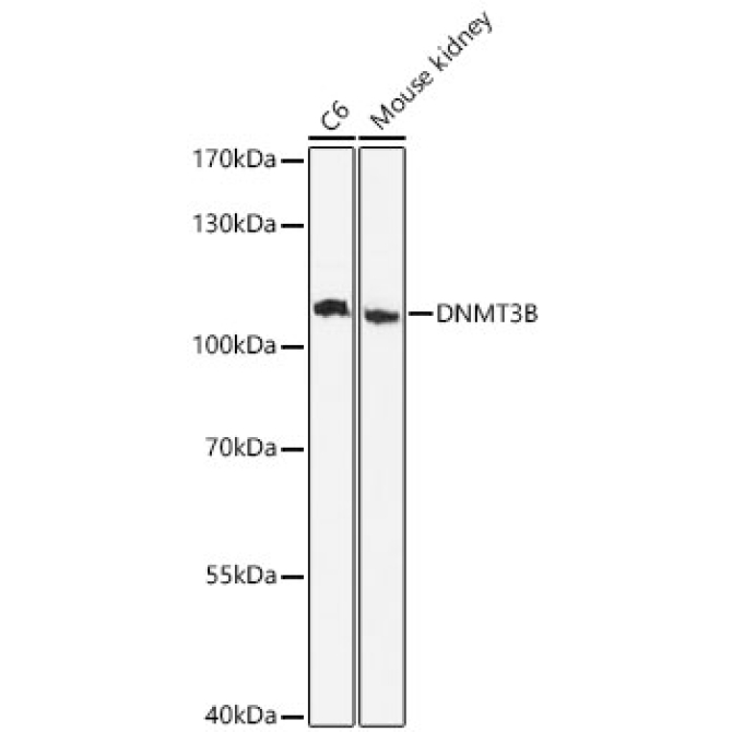DNMT3B Rabbit Polyclonal Antibody