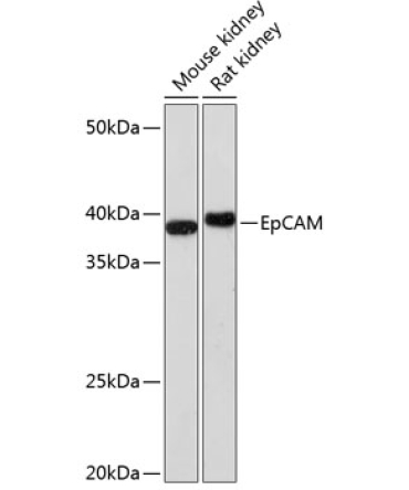EpCAM Rabbit Monoclonal Antibody