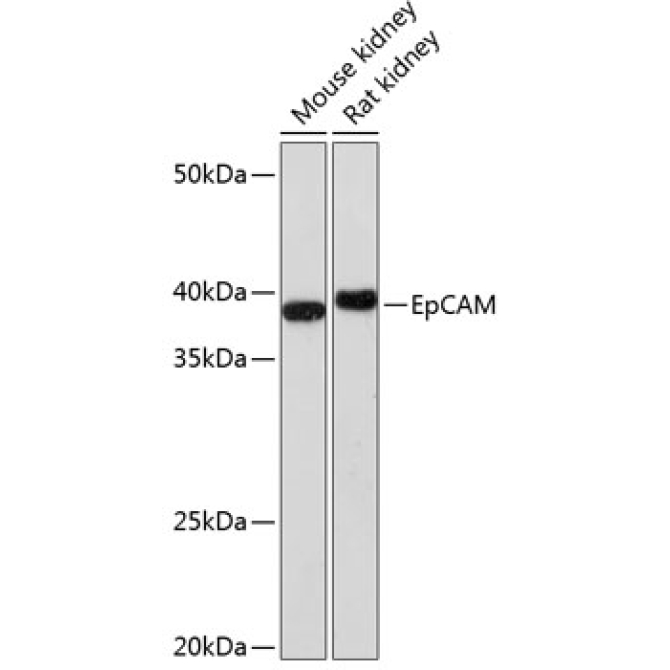 EpCAM Rabbit Monoclonal Antibody
