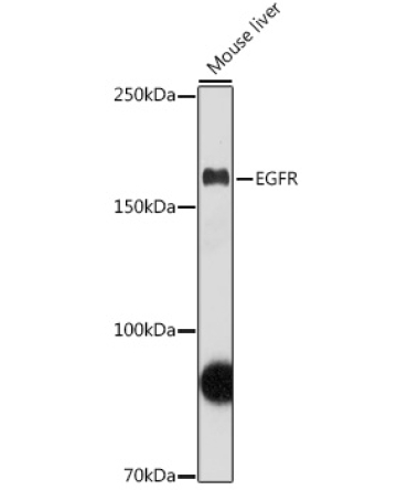 EGFR Rabbit Polyclonal Antibody [KD Validated]