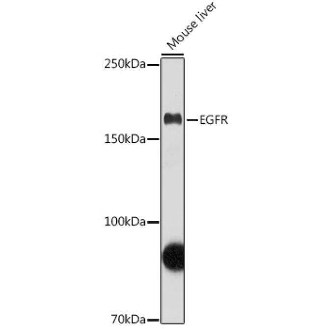 EGFR Rabbit Polyclonal Antibody [KD Validated]