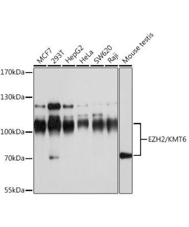 EZH2/KMT6 Rabbit Polyclonal Antibody