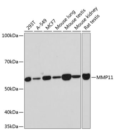MMP11 Rabbit Monoclonal Antibody