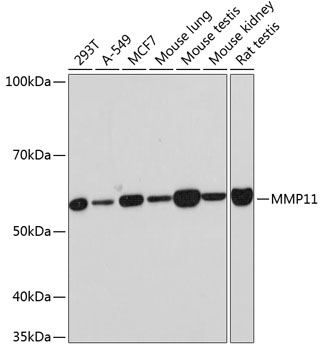 MMP11 Rabbit Monoclonal Antibody