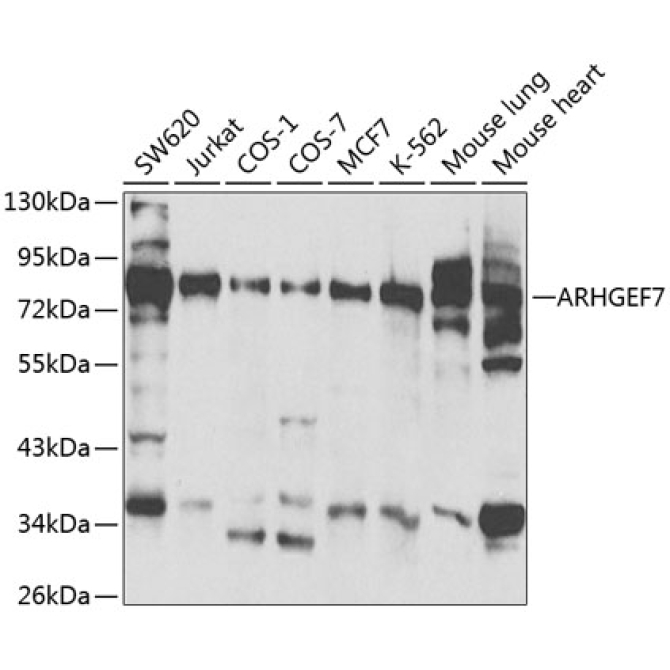 ARHGEF7 Rabbit Polyclonal Antibody