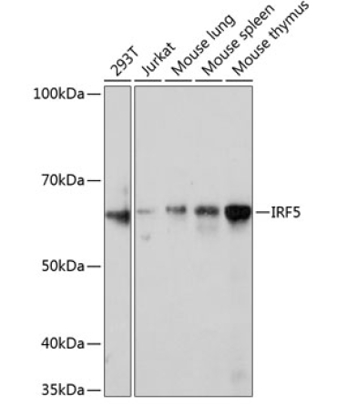 IRF5 Rabbit Monoclonal Antibody