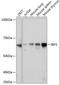IRF5 Rabbit Monoclonal Antibody
