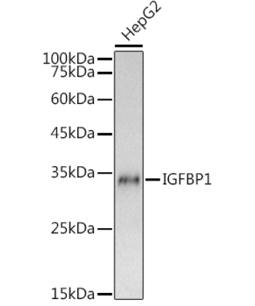 IGFBP1 Rabbit Polyclonal Antibody