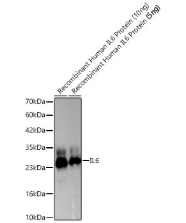 IL6 Rabbit Polyclonal Antibody