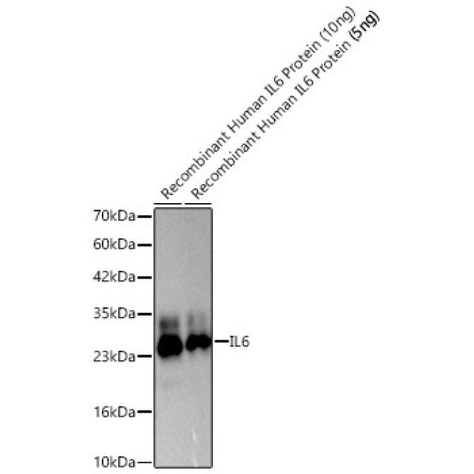 IL6 Rabbit Polyclonal Antibody