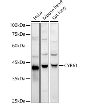 CYR61 Rabbit Polyclonal Antibody