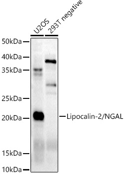 Lipocalin-2/NGAL Rabbit Polyclonal Antibody