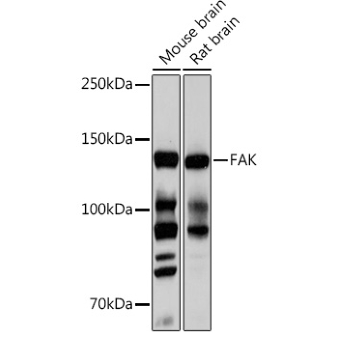 FAK Rabbit Monoclonal Antibody