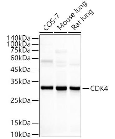 CDK4 Rabbit Monoclonal Antibody [KO Validated]