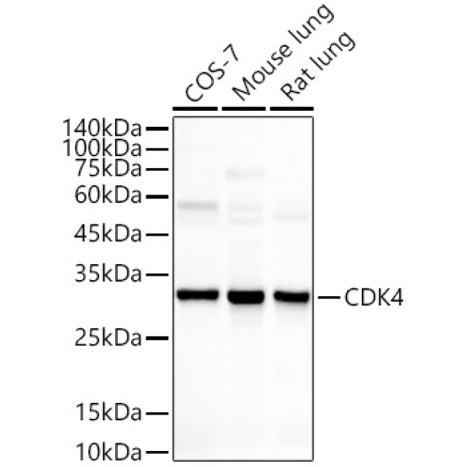 CDK4 Rabbit Monoclonal Antibody [KO Validated]