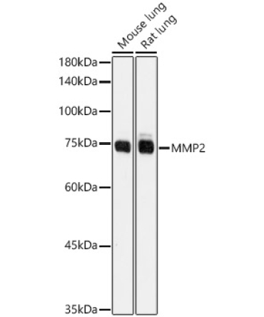 MMP2 Rabbit Polyclonal Antibody
