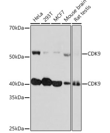CDK9 Rabbit Monoclonal Antibody [KO Validated]
