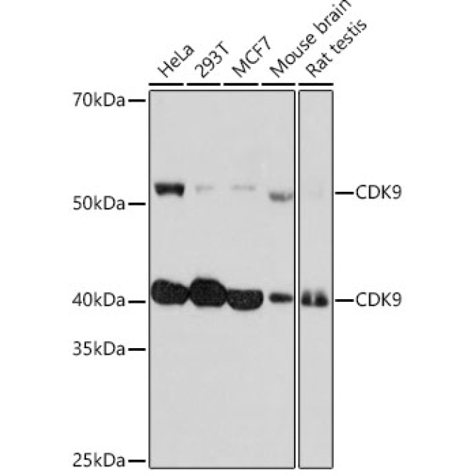 CDK9 Rabbit Monoclonal Antibody [KO Validated]