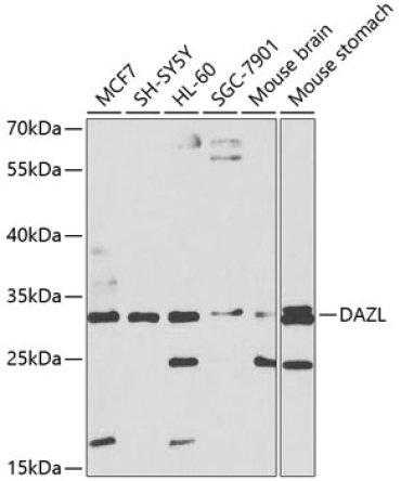 DAZL Rabbit Polyclonal Antibody