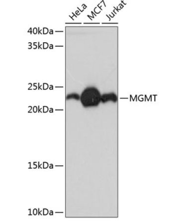 MGMT Rabbit Monoclonal Antibody