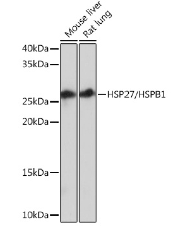 HSP27/HSPB1 Rabbit Monoclonal Antibody