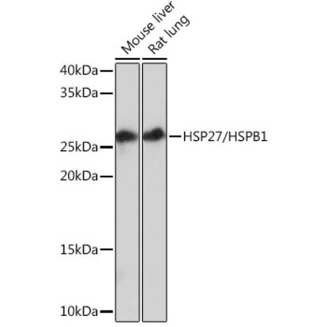 HSP27/HSPB1 Rabbit Monoclonal Antibody