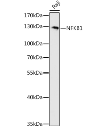 NFKB1 Rabbit Polyclonal Antibody
